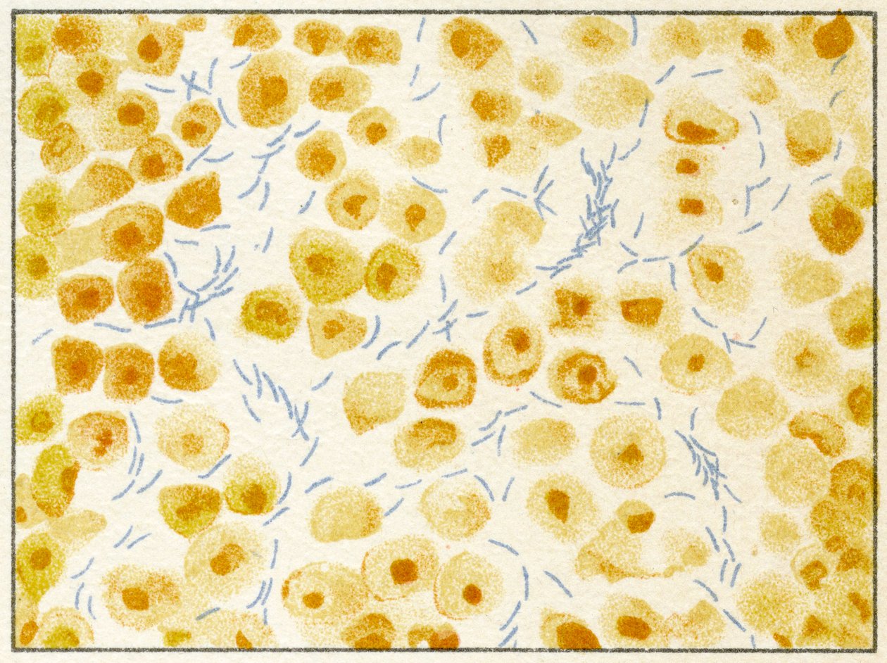 Tuberculosebacteriën in sputum door German School