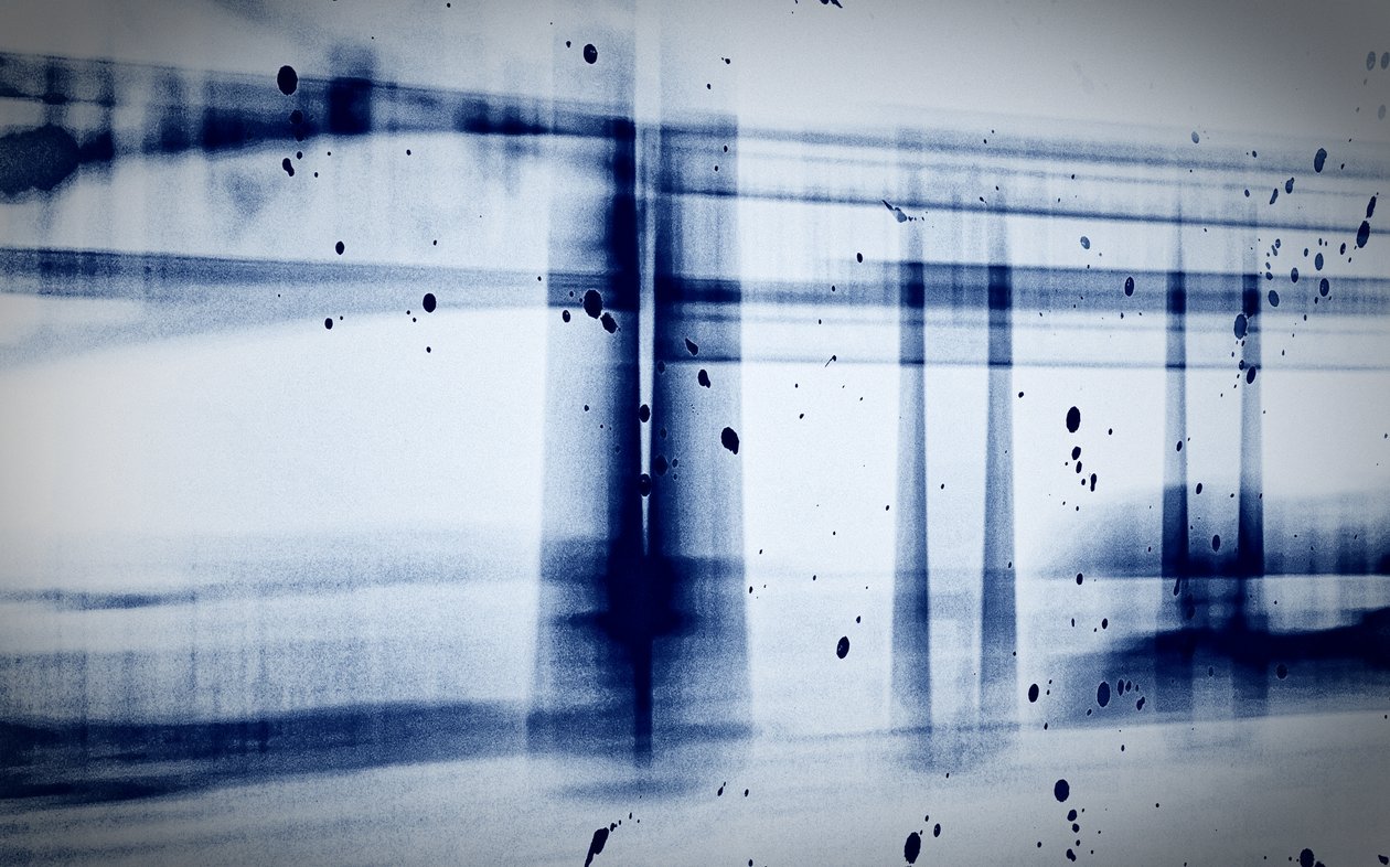 Sneeuw (röntgenfoto), 2019 door Alex Caminker