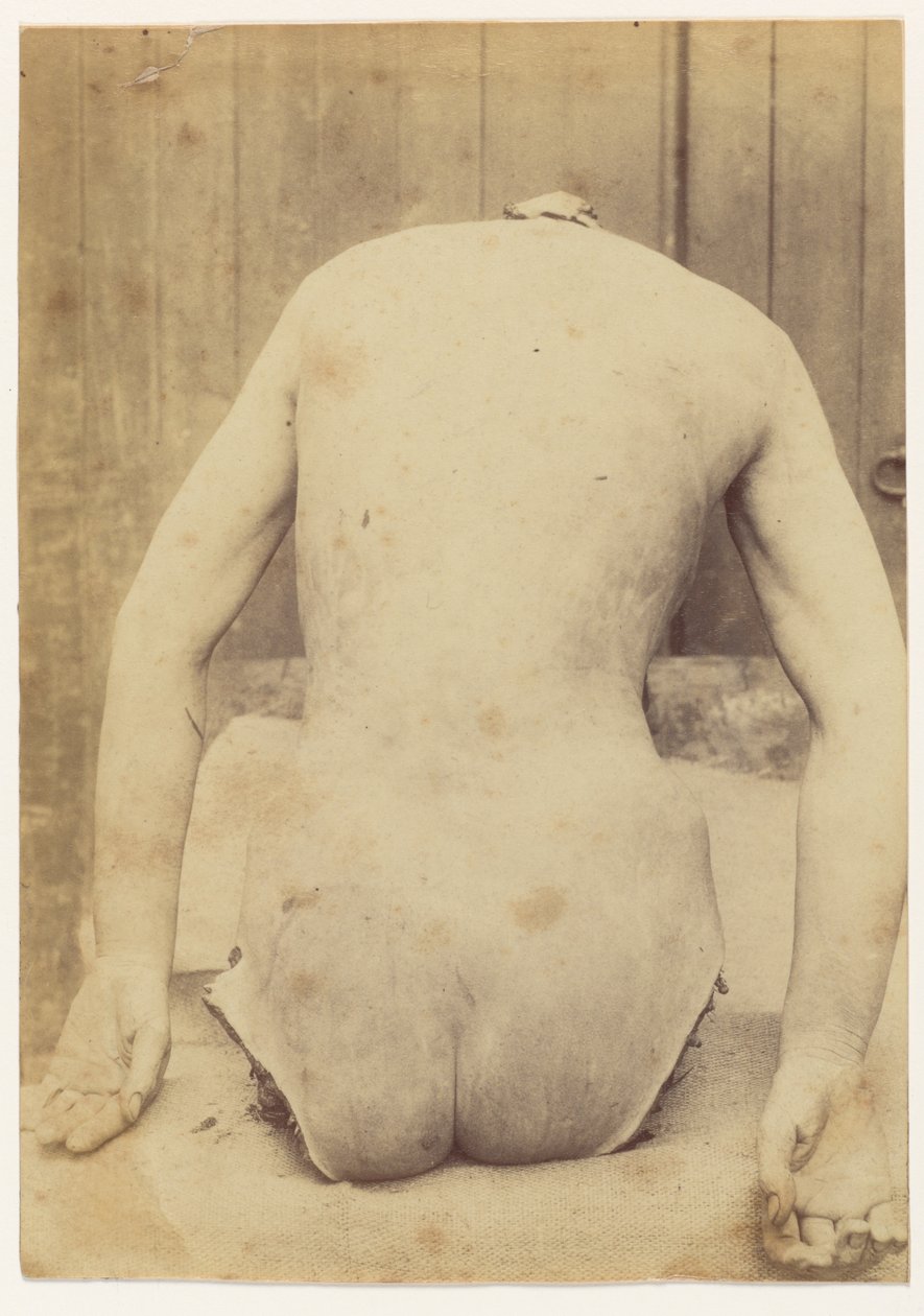 Achteraanzicht van de romp door Alphonse Bertillon