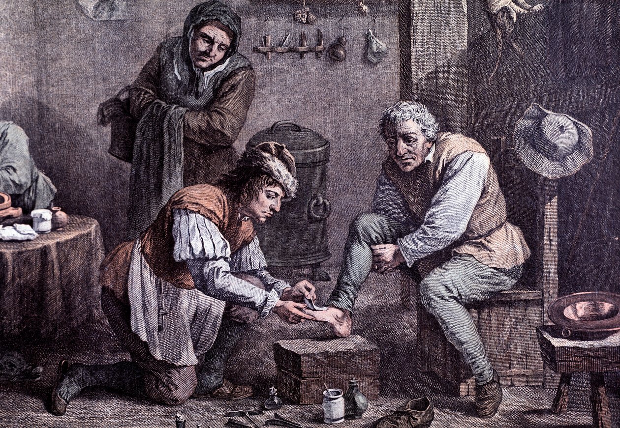 Een chirurgische operatie (gravure) door Anonymous Anonymous