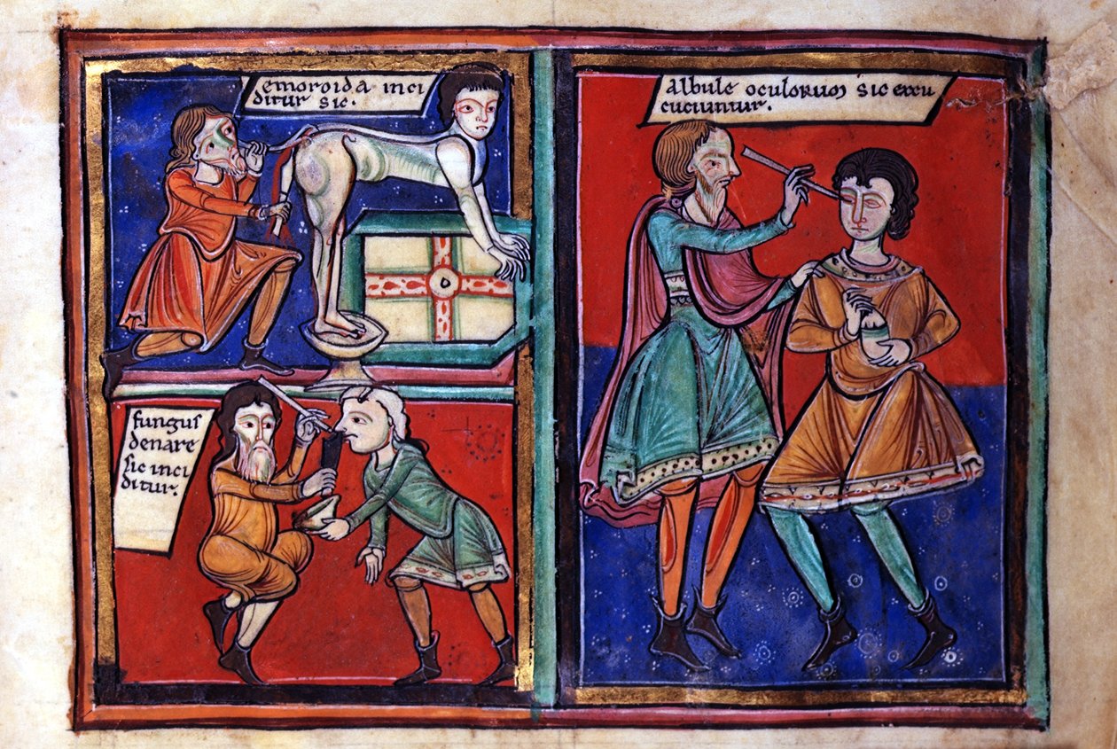 Sloane Ms 1975 fol.93 Medische operaties door English School