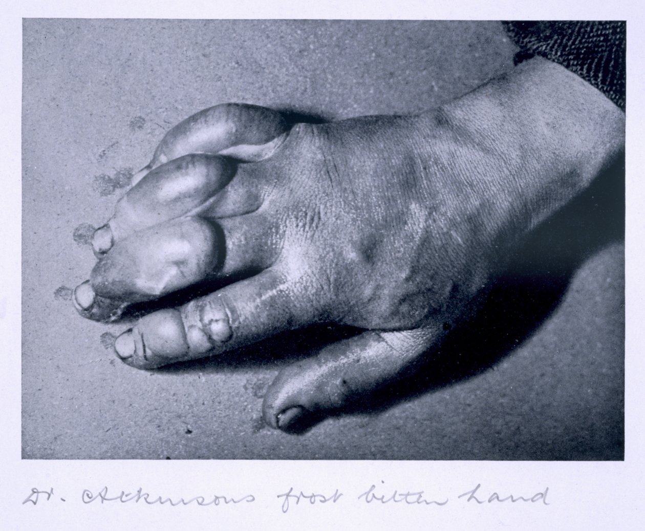 Dr. Atkinson