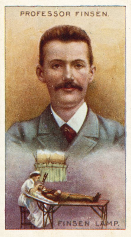 Professor Finsen, Finsen-lamp door English School